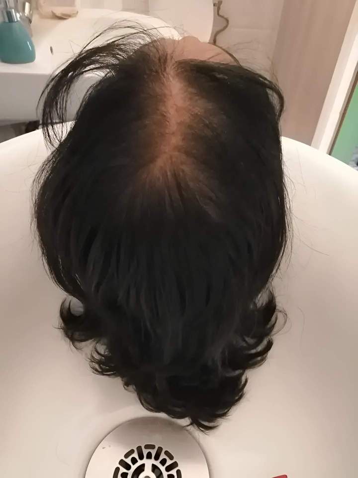 Trichothérapy La Réunion