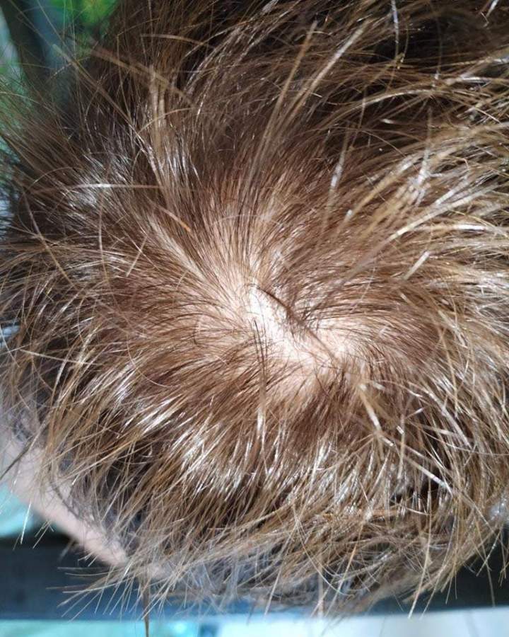 Trichothérapy La Réunion