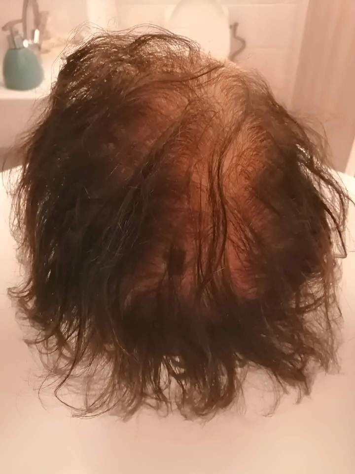 Trichothérapy La Réunion